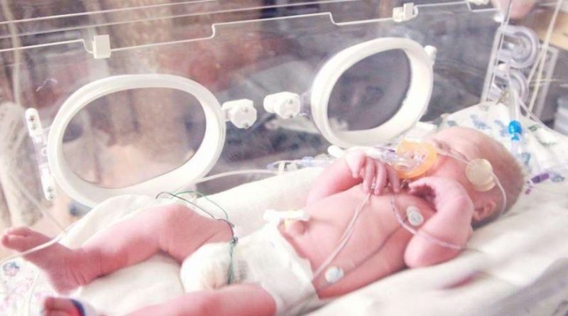 5 Cara Memberikan ASI pada Bayi Prematur